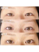 イチマルゴ ガーデン(105 GARDEN)/ダブルアイリフト(staff:RINA)