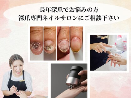エルナ(elna)の写真