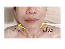 エステティックルーム マイサロン(mysalon.)/60代以降の方にも人気！