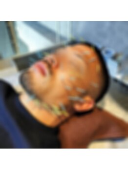 鍼灸院ネクストステップ(鍼灸院NextStep)/男の美容鍼!
