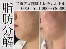 エースマイルイズ(A smile is..)