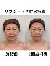 このはな(KONOHANA)/