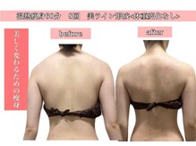 エステサロン ヴリエ 立川店/美しいラインは筋肉の形から