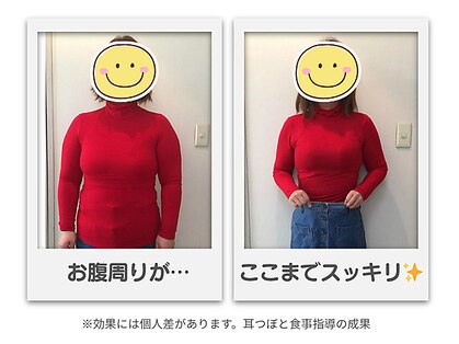 天使の耳の写真