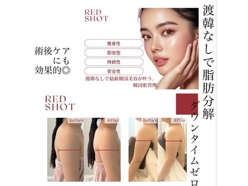 インディバサロン カルム(Calm.)の写真/自力では痩せにくい二の腕に！インディバ×レッドショットでピンポイントで脂肪分解攻撃！
