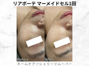 リライン(ReLine)/【マーメイドセル1回】