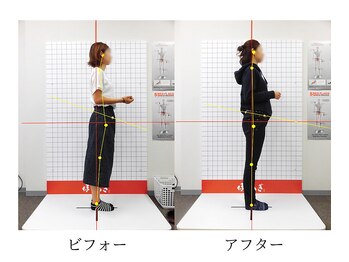 ほねつぎ 平成けやき通り鍼灸接骨院/骨盤矯正ビフォーアフター3