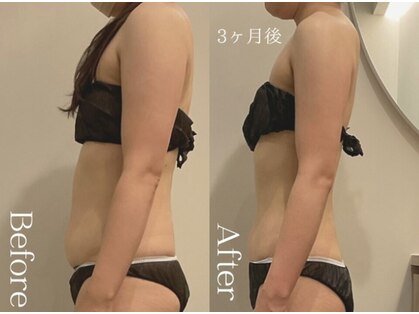 ユーフォリア グロウ(euphoria glow)の写真