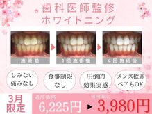 ホワイトニングカフェ 豊中店(WhiteningCafe)