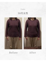 アンドゥ(Undo)/リンパで老廃物排出を促進