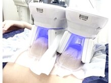 モテスリム/脂肪冷却でモテスリムに