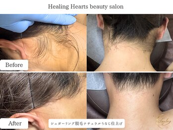 ヒーリングハーツ(Healing Hearts)/ブライダルシュガーリング♪