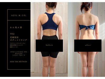 オーヴォ リビングスパ アネックス マノン(OVO LIVING SPA annex MANON)/【施術事例】花嫁ボディメイク