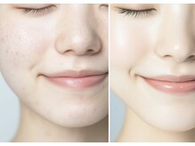 クレア 本店(CREA)の雰囲気(【美肌No1】IPLフォトでツヤ肌美人に!初回3000円)