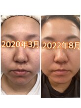 リコリナ(LikoLina)/