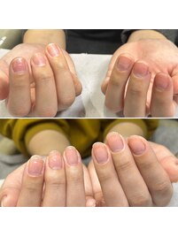 育爪ケアコース（2ヶ月経過）