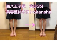 美容整体サロン オオカンシャ(okansha)/O脚Before→after