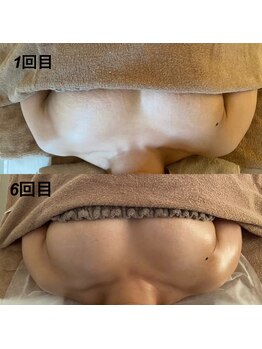 美人バスト 那覇店/バストアップ・育乳◆症例◆