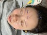 【美容鍼】フェイシャルマッサージ+ヒト幹細胞生パック付き
