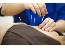 新宮中央整骨院 はりきゅう院/日々の疲れをリセット☆鍼灸施術