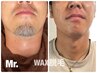 【Wax脱毛】ヒゲ脱毛3部位 (美容保湿パック) ¥9900