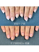 ネイルサロンアンドスクール マルベリー(mulberry)/江南市/自爪育成