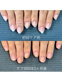 ネイルサロンアンドスクール マルベリー(mulberry)/江南市/自爪育成