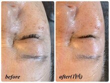 マリアンジュ(MariAnju)/シワたるみ改善ならプラズマ一択