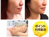 渡辺イチオシ【小顔矯正＋微弱電流で更に引き上げ】小顔アロマ＋立体小顔70分