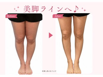 ヨサパーク トゥインクル(YOSAPARK twinkle)/本格リンパケア付き♪