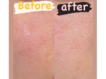 徳島美容サロン/Advanceコース