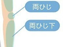 ボス 名張店(BOSS)/腕脱毛＃脱毛＃メンズ脱毛