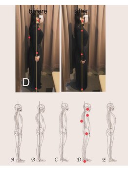 アイリー(Irie)/姿勢分析