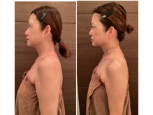 ココ 広島店(COCO)/巻き肩・二の腕の厚みもスッキリ