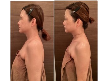 ココ 広島店(COCO)/巻き肩・二の腕の厚みもスッキリ