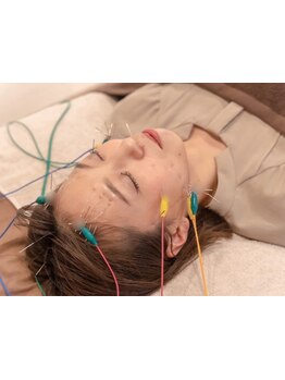 鍼灸施術を受けたい