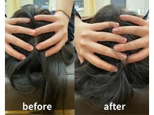 リファイン整体院 国分寺店/小顔、骨盤、ヘッドスパ、整体