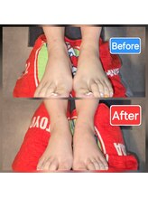 足つぼまーさん/足首のむくみもスッキリ！