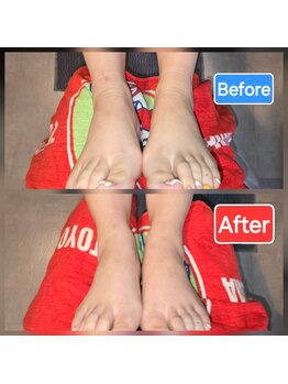 足つぼまーさん/足首のむくみもスッキリ!
