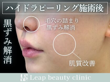 リープ(Leap)の写真