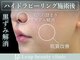 リープ(Leap)の写真