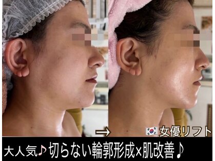 アルページュ(Arpege)の写真