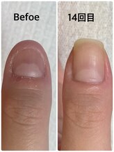 グラティアラ 銀座/お客様のビフォーアフター写真