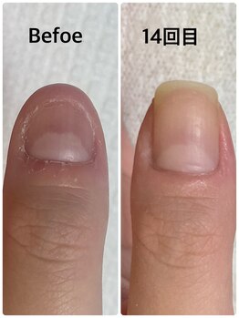 グラティアラ 銀座/お客様のビフォーアフター写真