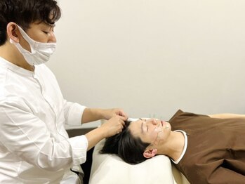 フラット(flat)/小顔美容鍼メンズにもオススメ