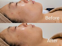 イクヨノ ビューティーサロン(194's beauty salon)の雰囲気（剥がさず刺激を起こさせない【育てるハーブピーリング】）