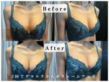 パフューム(Perfume)/