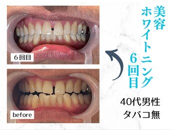 ルカノン(le canon)/清潔感がアップしました!(^^)!