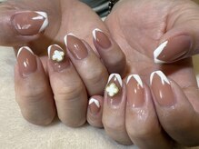 チレンテ(Chi-lente)