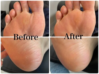 リエル(Riel)/足裏つるつる”かかと角質ケア”